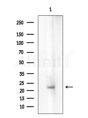 CABP7 Antibody - Western blot analysis of extracts from A375 cells(starvation treatment), using CABP7 Antibody at 1/1000 dilution.