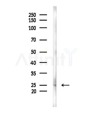 CABP7 Antibody - Western blot analysis of lysates from A375 cells(starvation treatment), using CABP7 Antibody at 1/1000 dilution.