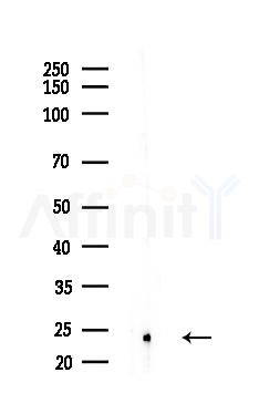 CHP Antibody - Western blot analysis of lysates from B16F10-LUC cells(heat-shock,45min treatment), using CHP Antibody at 1/1000 dilution.