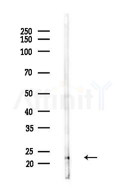 CHP Antibody - Western blot analysis of lysates from Mouse liver, using CHP Antibody at 1/1000 dilution.