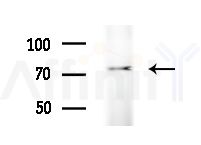 CAPN10 Antibody - Western blot analysis of extracts from HepG2 cells
(heat-shock treatment), using CAPN10 Antibody at 1/1000 dilution.