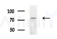 CAPN10 Antibody - Western blot analysis of extracts from B16F10-LUC cells
(heat-shock treatment), using CAPN10 Antibody at 1/1000 dilution.