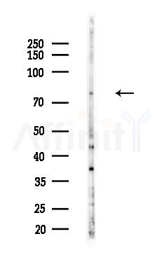 CAPN10 Antibody - Western blot analysis of lysates from B16F10-LUC cells(heat-shock,45min treatment), using CAPN10 Antibody at 1/1000 dilution.