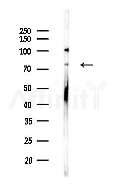 CAPN10 Antibody - Western blot analysis of lysates from HepG2 cells(heat-shock,45min treatment), using CAPN10 Antibody at 1/1000 dilution.