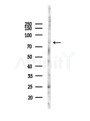 CAPN11 Antibody - Western blot analysis of lysates from HepG2 cells(heat-shock,45min treatment), using CAPN11 Antibody at 1/1000 dilution.