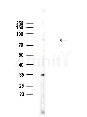 CAPN12 Antibody - Western blot analysis of lysates from LoVo cells(heat-shock,45min treatment), using CAPN12 Antibody at 1/1000 dilution.