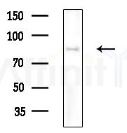 CAPN9 Antibody - Western blot analysis of extracts from Rat brain, using CAPN9 Antibody at 1/1000 dilution.