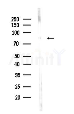 CAPN9 Antibody - Western blot analysis of lysates from Rat brain, using CAPN9 Antibody at 1/1000 dilution.