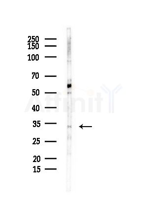 CNN2 Antibody - Western blot analysis of lysates from EC304 cells, using CNN2 Antibody at 1/1000 dilution.