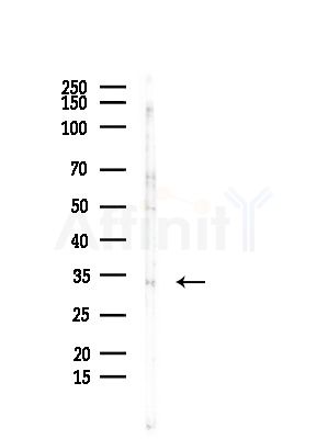 CNN2 Antibody - Western blot analysis of lysates from COLO205 cells, using CNN2 Antibody at 1/1000 dilution.