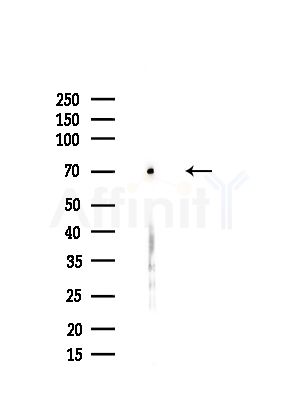ARPP21 Antibody - Western blot analysis of lysates from HUVEC cells(starvation,24h treatment), using ARPP21 Antibody at 1/1000 dilution.