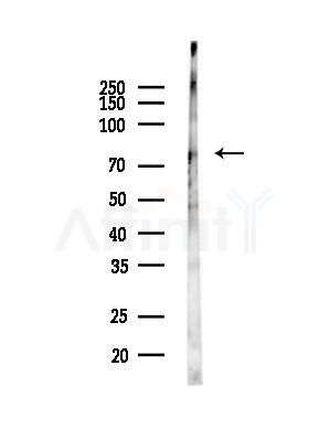 PDE4C Antibody - Western blot analysis of lysates from HUVEC cells(LPC4h treatment), using PDE4C Antibody at 1/1000 dilution.