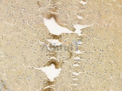 ABCC3 Antibody - DF3874 at 1/100 staining human normal liver tissue by IHC-P.