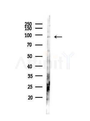 CAGE1 Antibody - Western blot analysis of lysates from MDA-MB-231 cells(heat-shock,45min treatment), using CAGE1 Antibody at 1/1000 dilution.