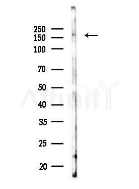 CLIP1 Antibody - Western blot analysis of lysates from COLO205 cells(UV,30min treatment), using CLIP1 Antibody at 1/1000 dilution.