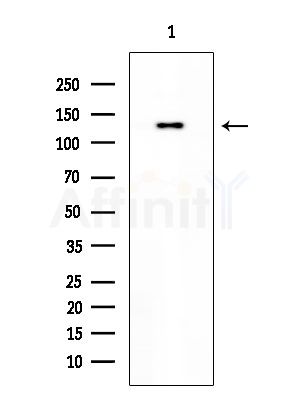 CLIP2 Antibody - Western blot analysis of extracts from EC304 cells, using CLIP2 Antibody at 1/1000 dilution.