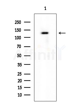 CLIP2 Antibody - Western blot analysis of extracts from COLO205 cells, using CLIP2 Antibody at 1/1000 dilution.