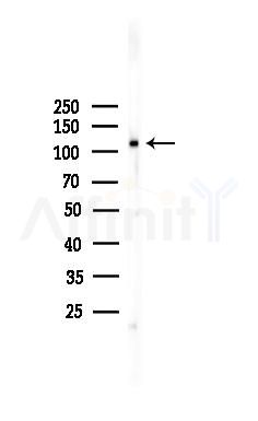 CLIP2 Antibody - Western blot analysis of lysates from COLO205 cells, using CLIP2 Antibody at 1/1000 dilution.
