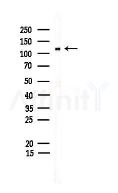 CLIP2 Antibody - Western blot analysis of lysates from EC304 cells, using CLIP2 Antibody at 1/1000 dilution.