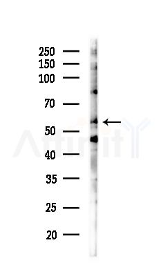 CLIP3 Antibody - Western blot analysis of lysates from Mouse brain, using CLIP3 Antibody at 1/1000 dilution.