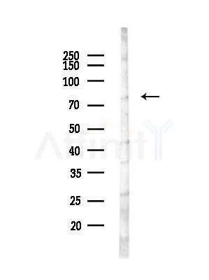 CLIP4 Antibody - Western blot analysis of lysates from EC304 cells(heat-shock,45min treatment), using CLIP4 Antibody at 1/1000 dilution.