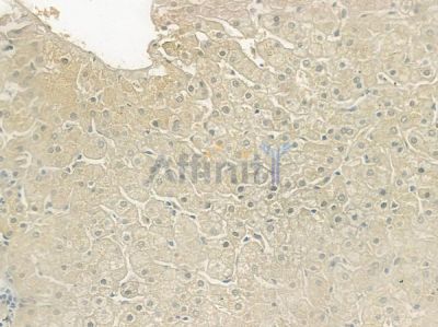 CHST13 Antibody - DF3882 at 1/100 staining human normal liver tissue by IHC-P.