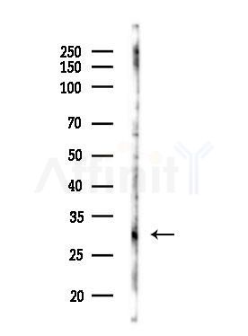 Carbonic Anhydrase 1/CA1 Antibody - Western blot analysis of lysates from COLO205 cells(UV,30min treatment), using Carbonic Anhydrase 1/CA1 Antibody at 1/1000 dilution.