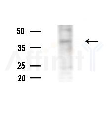 CA12 Antibody - Western blot analysis of lysates from Rat brain, using CA12 Antibody at 1/1000 dilution.