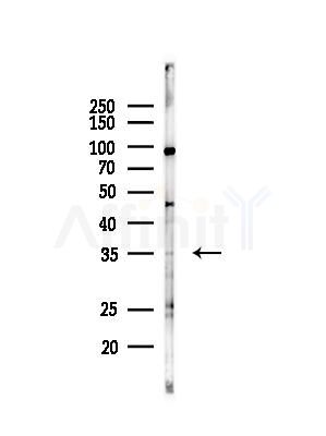 CA13 Antibody - Western blot analysis of lysates from B16F10-LUC cells(heat-shock,45min treatment), using CA13 Antibody at 1/1000 dilution.