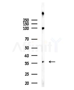 CA3 Antibody - Western blot analysis of lysates from Rat brain, using CA3 Antibody at 1/1000 dilution.