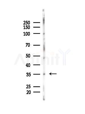 CA6 Antibody - Western blot analysis of lysates from LoVo cells(heat-shock,45min treatment), using CA6 Antibody at 1/1000 dilution.