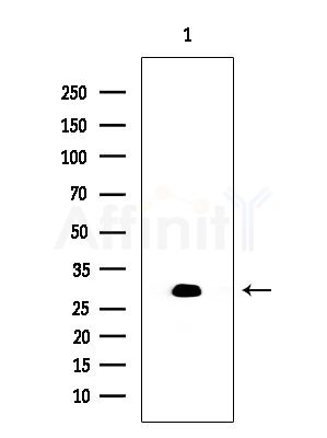 CBR1 Antibody - Western blot analysis of extracts from EC304 cells, using CBR1 Antibody at 1/1000 dilution.
