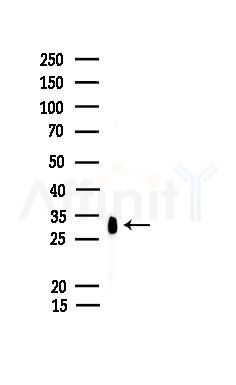 CBR1 Antibody - Western blot analysis of lysates from EC304 cells, using CBR1 Antibody at 1/1000 dilution.