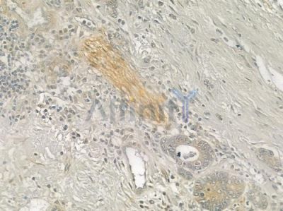 CBR1 Antibody - DF3893 at 1/100 staining human normal liver tissue by IHC-P.