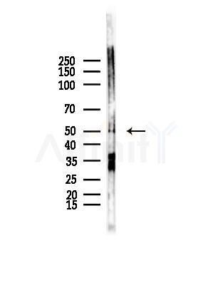 CPA5 Antibody - Western blot analysis of lysates from HepG2 cells(starvation,24h treatment), using CPA5 Antibody at 1/1000 dilution.