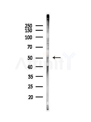 CPB2 Antibody - Western blot analysis of lysates from B16F10-LUC cells(heat-shock,45min treatment), using CPB2 Antibody at 1/1000 dilution.