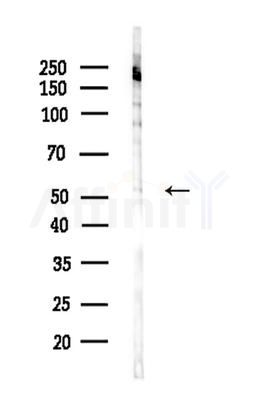 CPN1 Antibody - Western blot analysis of lysates from HepG2 cells(LPS 4h treatment), using CPN1 Antibody at 1/1000 dilution.
