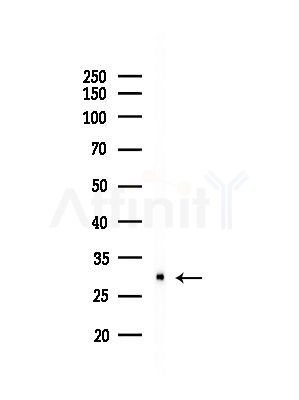 CTDSP1 Antibody - Western blot analysis of lysates from Hela cells(starvation,24h treatment), using CTDSP1 Antibody at 1/1000 dilution.