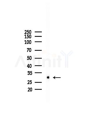 CTDSP1 Antibody - Western blot analysis of lysates from LoVo cells(heat-shock,45min treatment), using CTDSP1 Antibody at 1/1000 dilution.