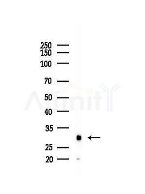 CTDSP1 Antibody - Western blot analysis of lysates from Mouse liver, using CTDSP1 Antibody at 1/1000 dilution.