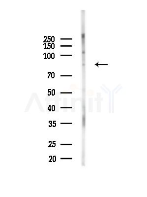 CPT1B Antibody - Western blot analysis of lysates from Mouse brain, using CPT1B Antibody at 1/1000 dilution.