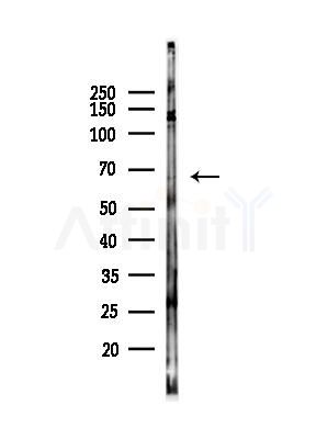 SLC7A4 Antibody - Western blot analysis of lysates from B16F10-LUC cells(heat-shock,45min treatment), using SLC7A4 Antibody at 1/1000 dilution.