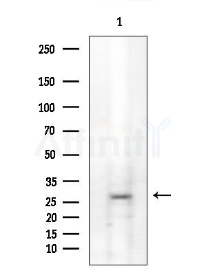 BORG1 Antibody - Western blot analysis of extracts from EC304 cells, using BORG1 Antibody at 1/1000 dilution.