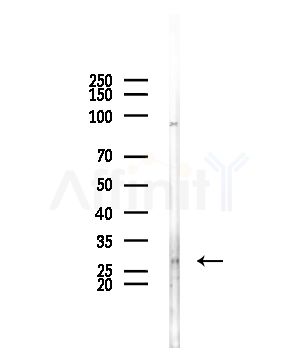 BORG1 Antibody - Western blot analysis of lysates from EC304 cells, using BORG1 Antibody at 1/1000 dilution.
