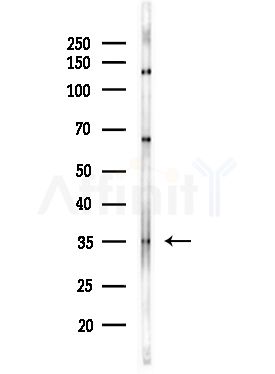 BORG2 Antibody - Western blot analysis of lysates from Hela cells(starvation,24h treatment), using BORG2 Antibody at 1/1000 dilution.