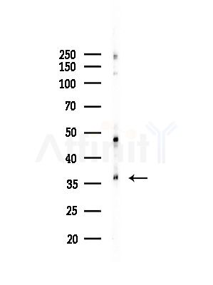 BORG4 Antibody - Western blot analysis of lysates from Hela cells(starvation,24h treatment), using BORG4 Antibody at 1/1000 dilution.
