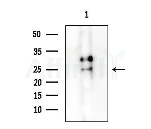 CRABP2 Antibody - Western blot analysis of extracts from COLO205 cells, using CRABP2 Antibody at 1/1000 dilution.