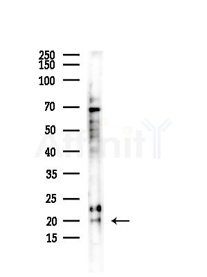 CRABP2 Antibody - Western blot analysis of lysates from COLO205 cells, using CRABP2 Antibody at 1/1000 dilution.