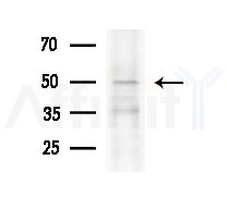 CEP57 Antibody - Western blot analysis of extracts from HepG2 cells
(heat-shock treatment), using CEP57 Antibody at 1/1000 dilution.