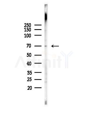 CEP70 Antibody - Western blot analysis of lysates from EC304 cells(heat-shock,45min treatment), using CEP70 Antibody at 1/1000 dilution.